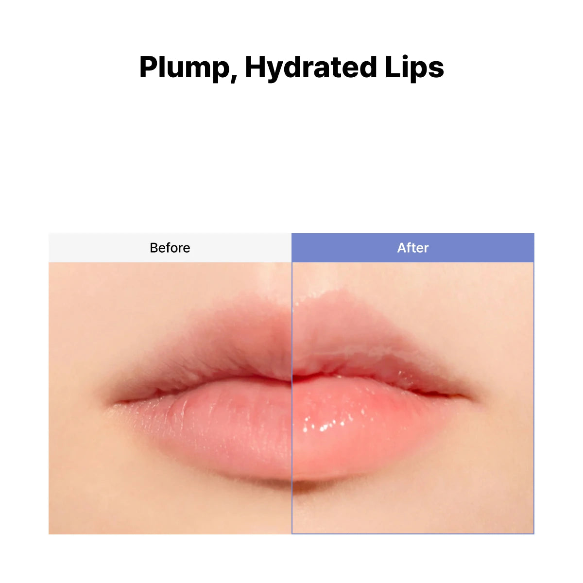 VT Reedle Shot Lip Plumper Beginner