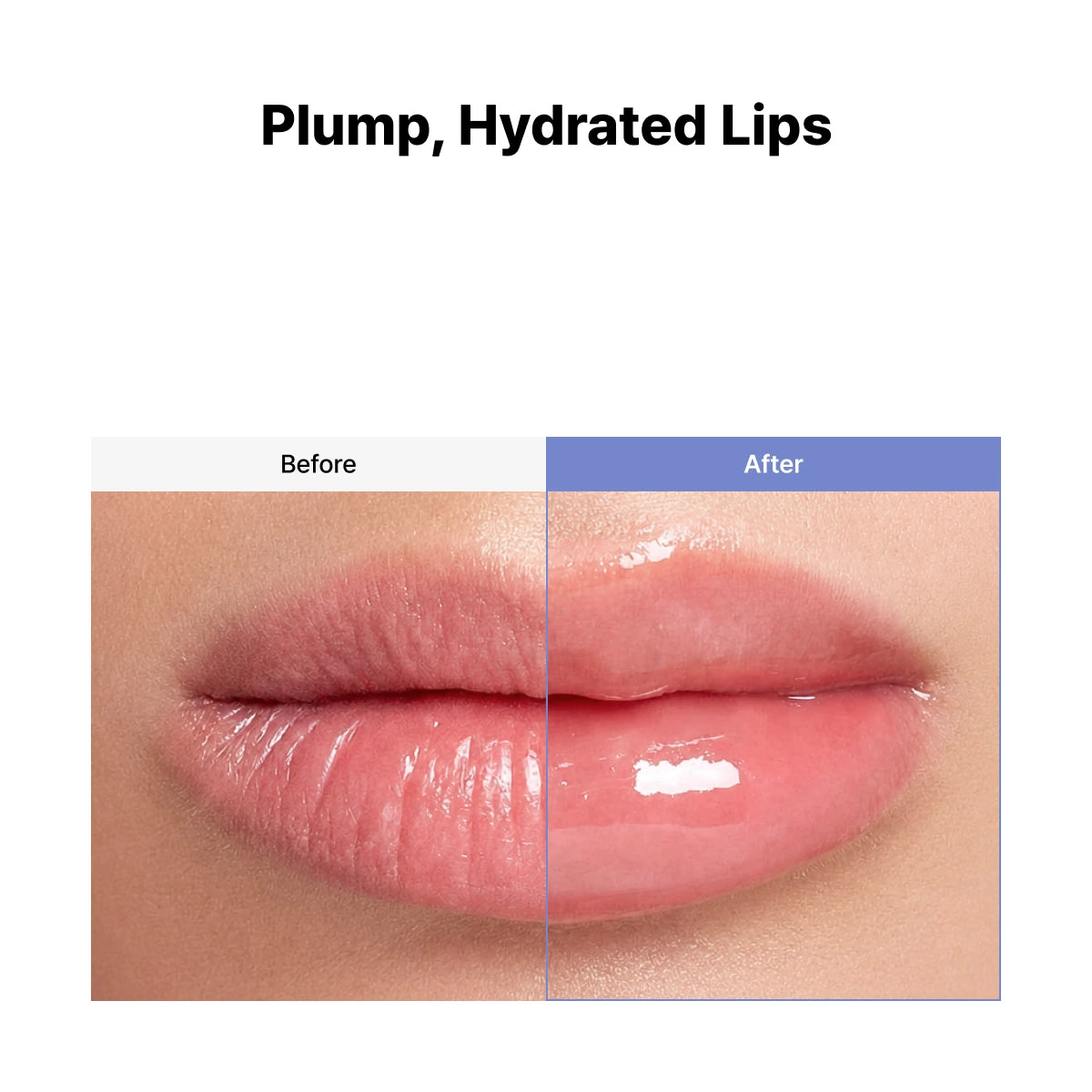 VT Reedle Shot Lip Plumper Expert