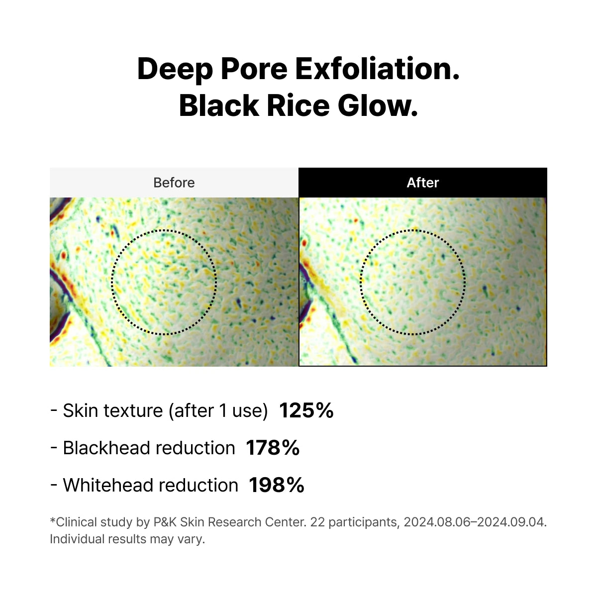 Dr. melaxin Peel Shot Exfoliating Black Rice Ampoule