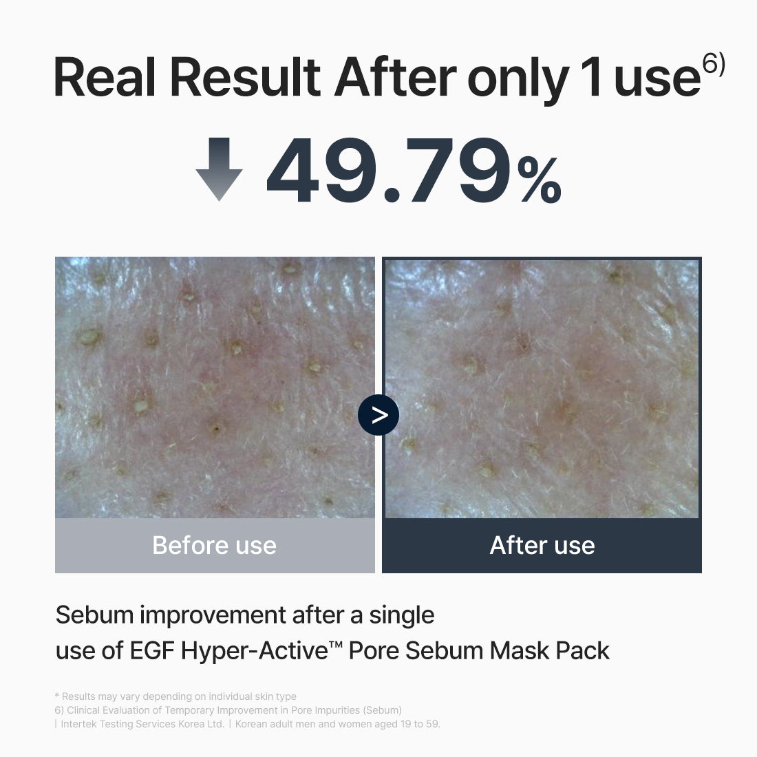 FROMRIER EGF Hyper Active Pore Sebum Mask 4 EA