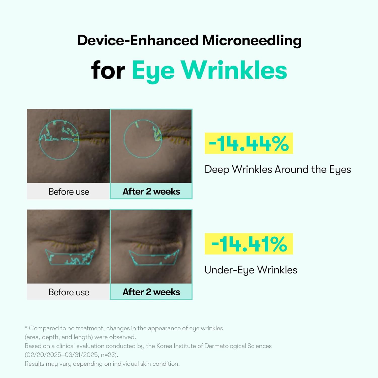 VT PDRN Reedle Shot Eye Lifter
